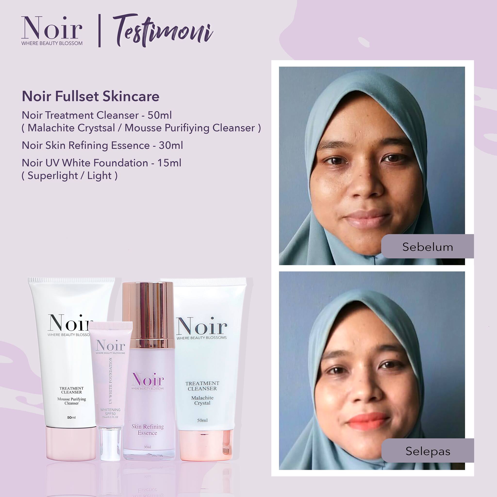 Noir full set skincare testimoni Full set skincare Noir