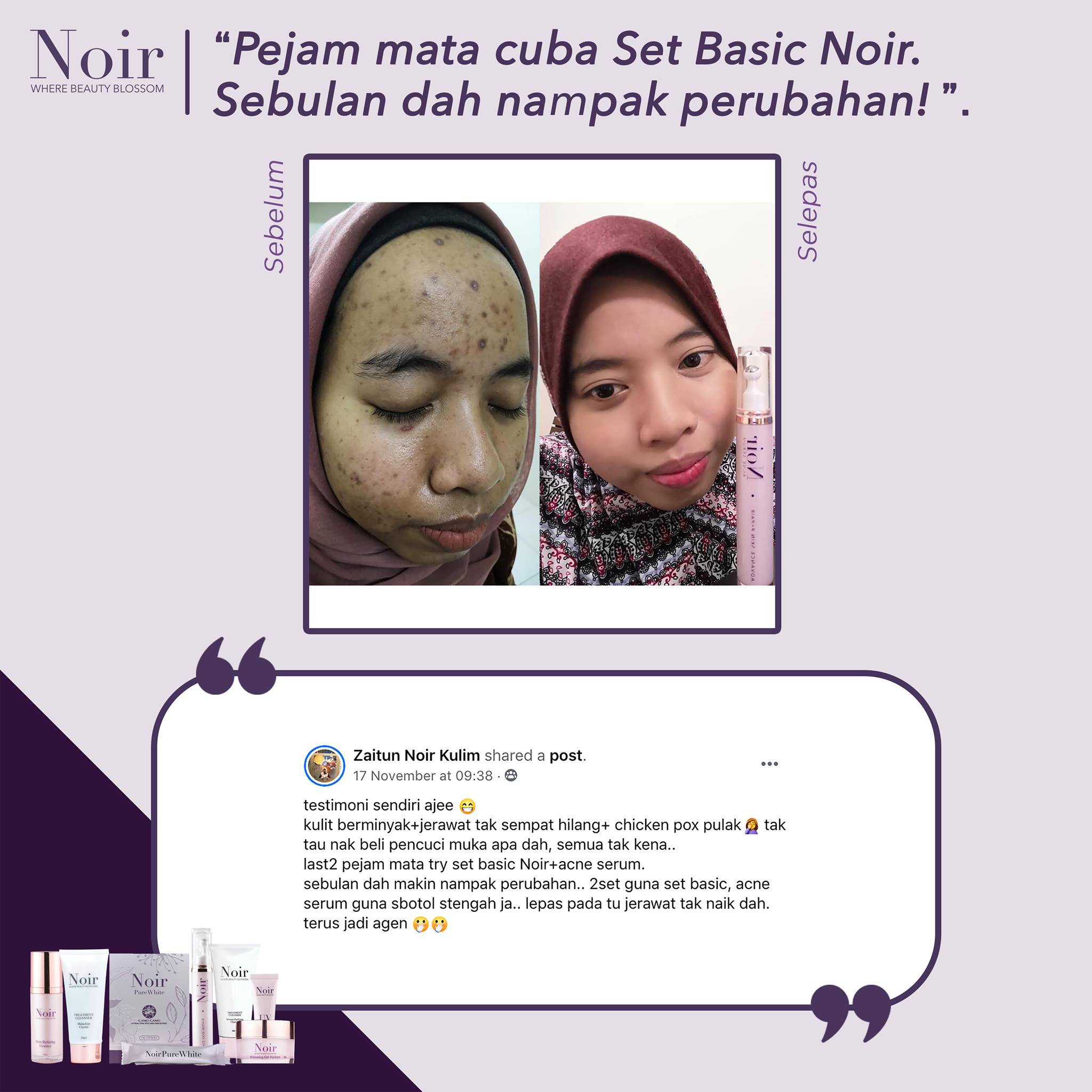 Noir testimoni set basic Noir yang terbaik