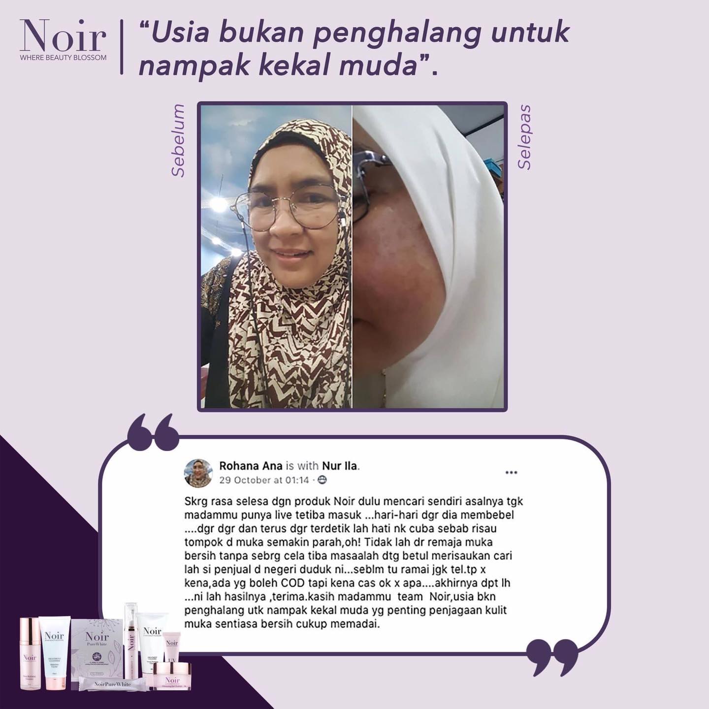 Noir testimoni tompok hilang Skincare Noir Testimoni