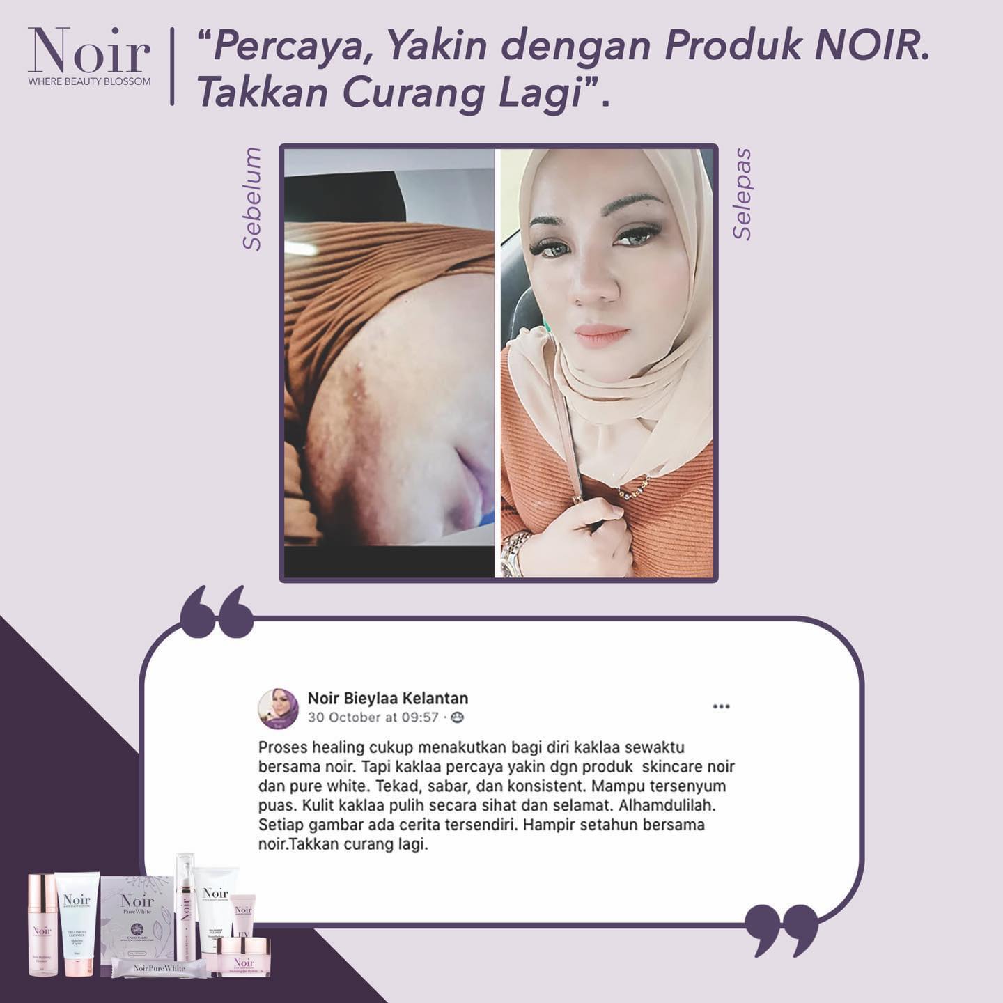 Noir tetsimoni Bieyla Testimoni Pure White