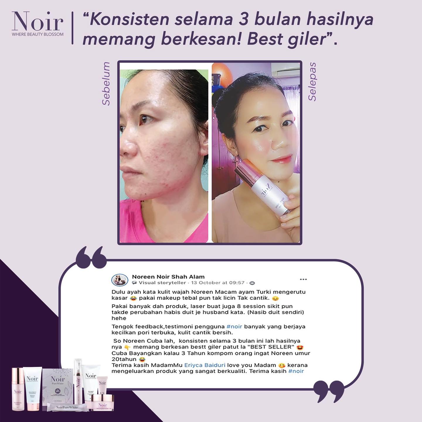 Noir tetsimoni Noreen Noir Skincare Testimoni